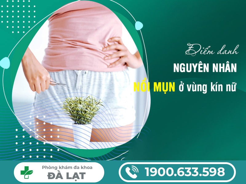 Hình ảnh minh họa